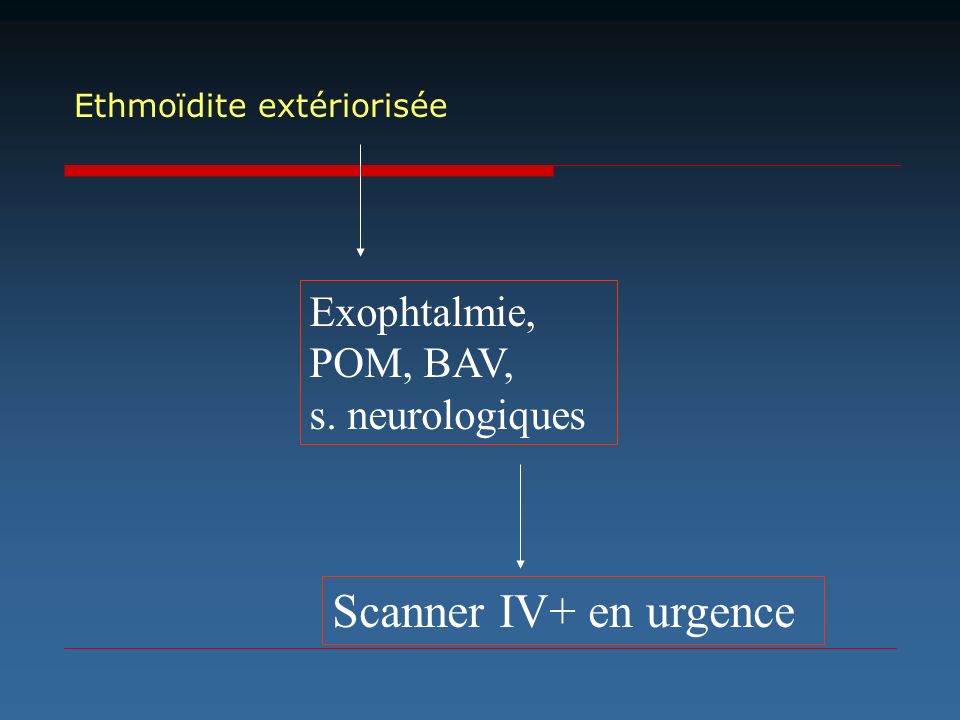 Scanner IV+ en urgence Exophtalmie, POM, BAV, s. neurologiques