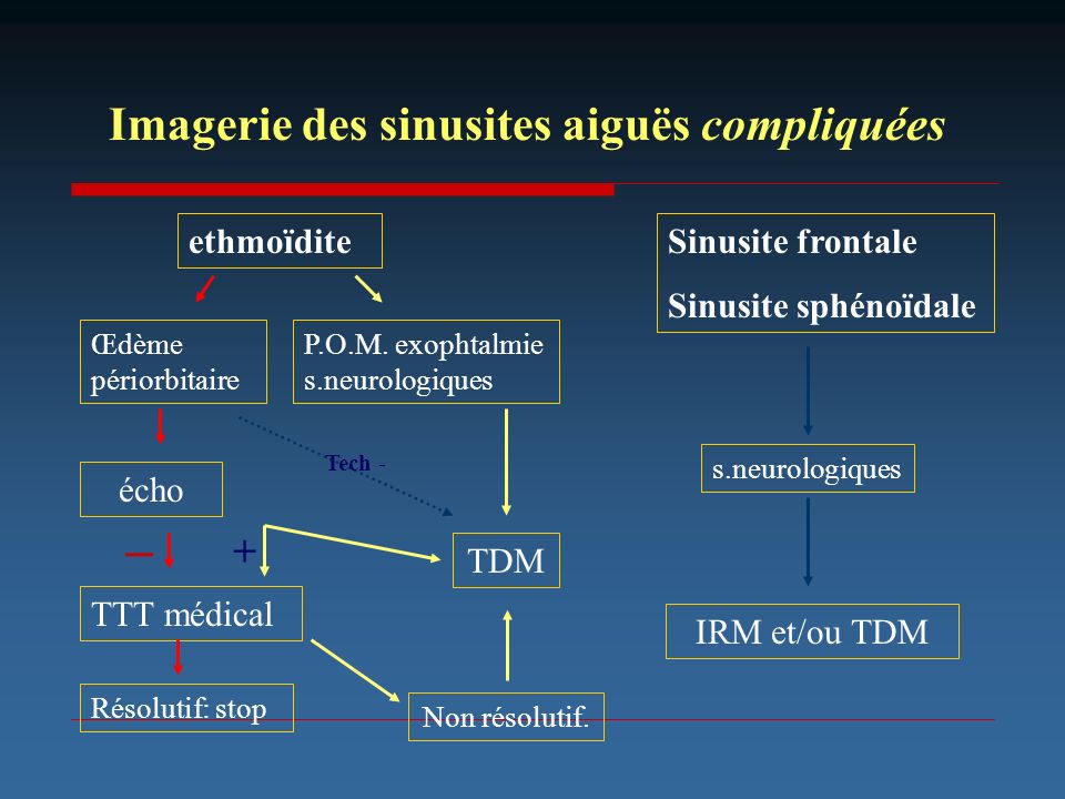 _ Imagerie des sinusites aiguës compliquées + ethmoïdite