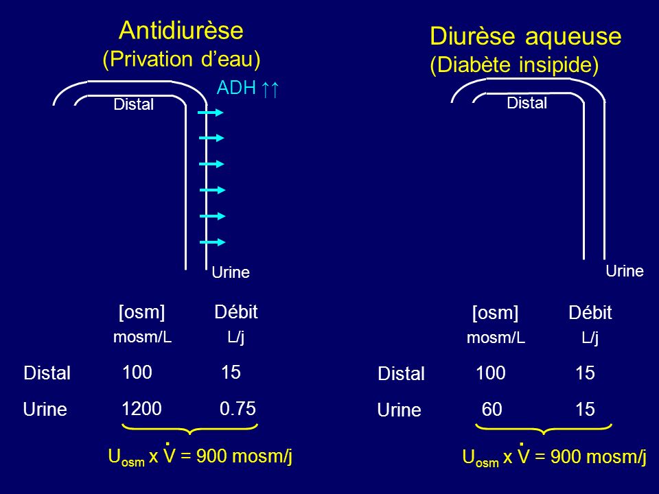 Antidiurèse (Privation d’eau)
