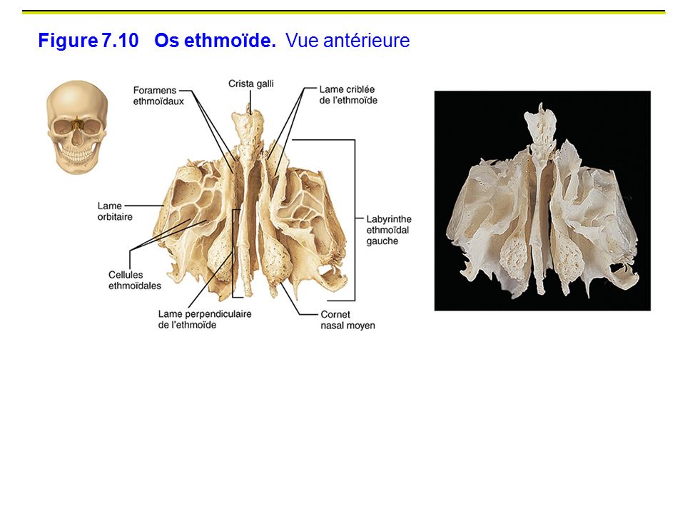 Figure 7.10 Os ethmoïde. Vue antérieure