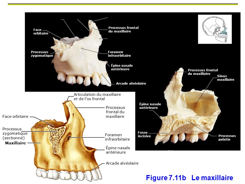Figure 7.11b Le maxillaire 2 os maxillaire