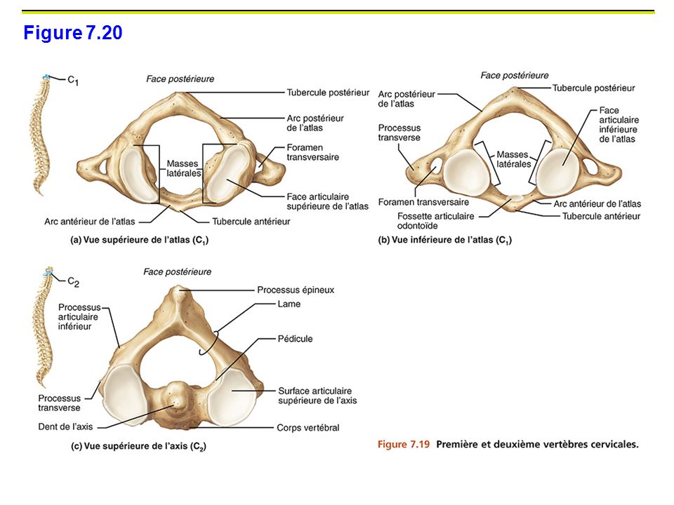 Figure 7.20 C1 : atlas. Anneaux osseux sans corps vertbrale (pas de disque entre atlas et os occupitale ou C2)