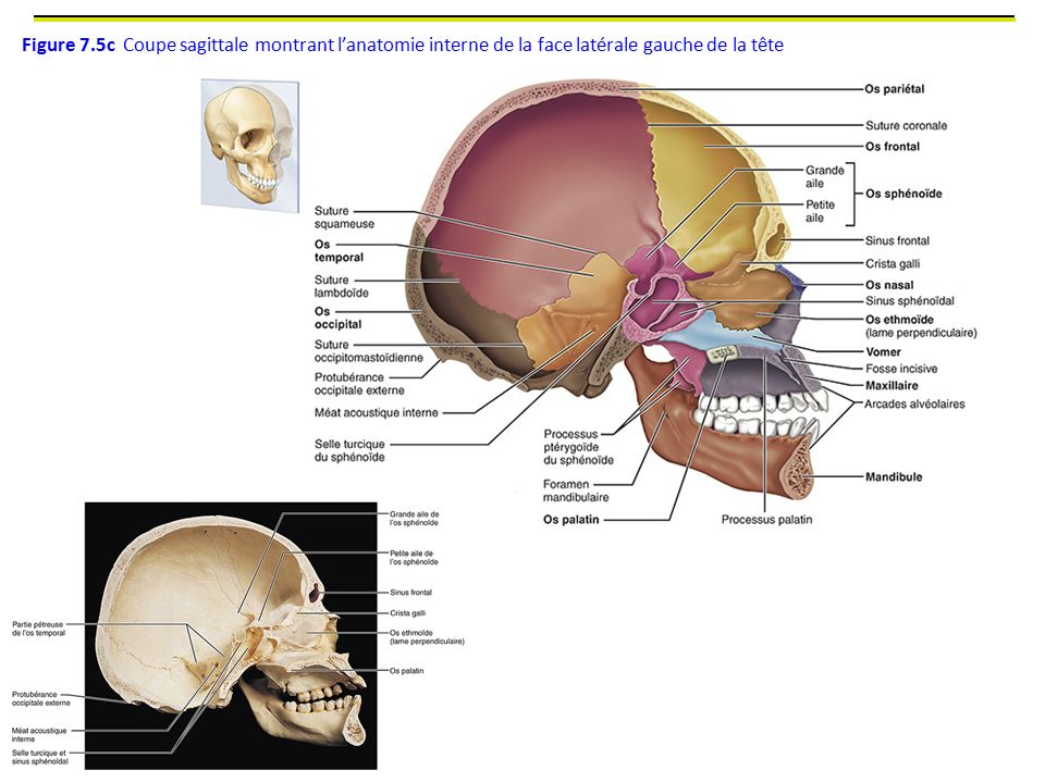 Figure 7.5c Coupe sagittale montrant l’anatomie interne de la face latérale gauche de la tête