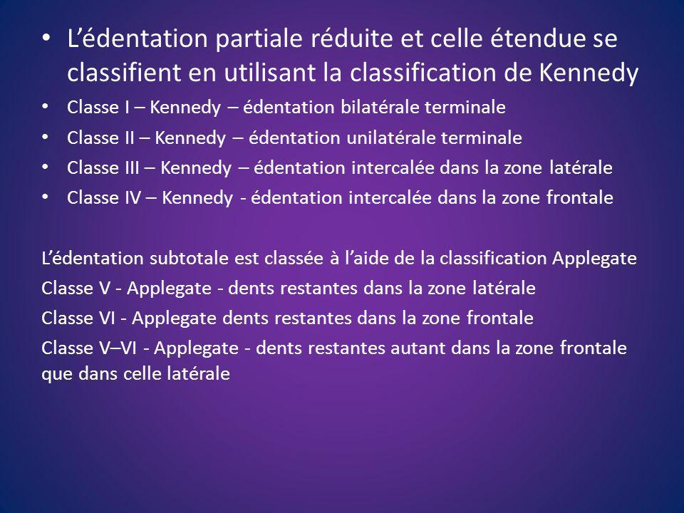 L’édentation partiale réduite et celle étendue se classifient en utilisant la classification de Kennedy