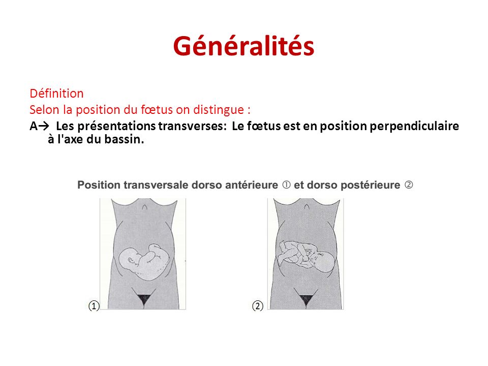 Positions Transversales Et Obliques Ppt Video Online Telecharger