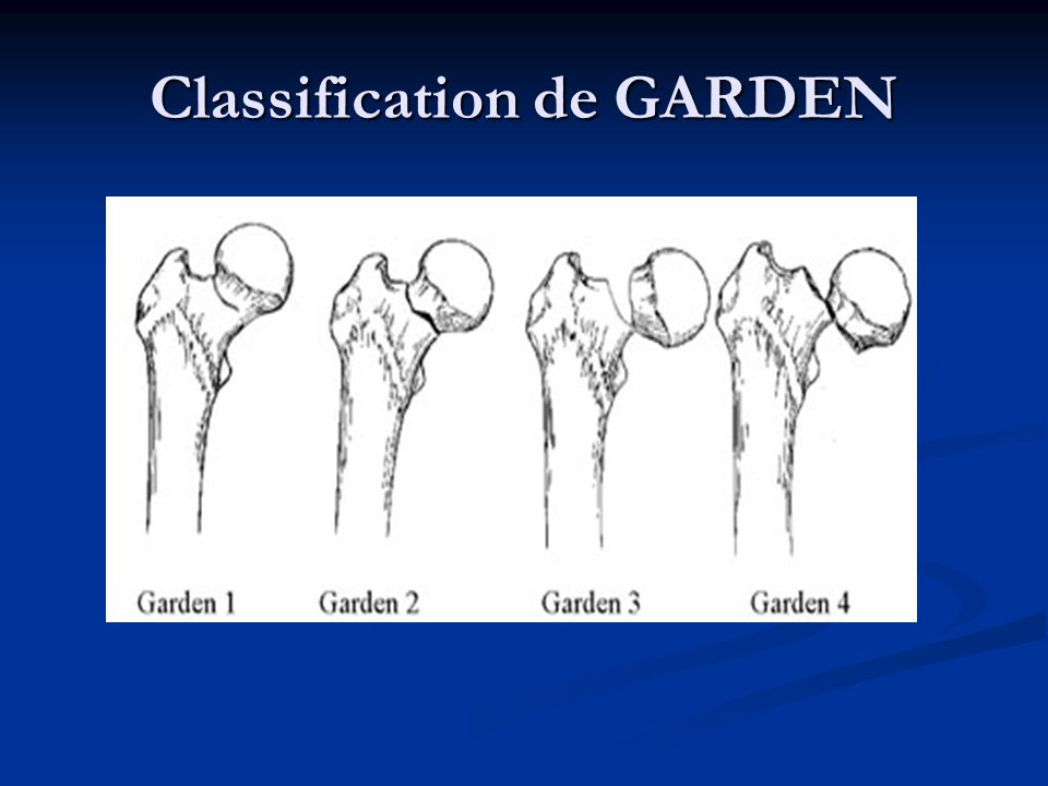 Classification de GARDEN