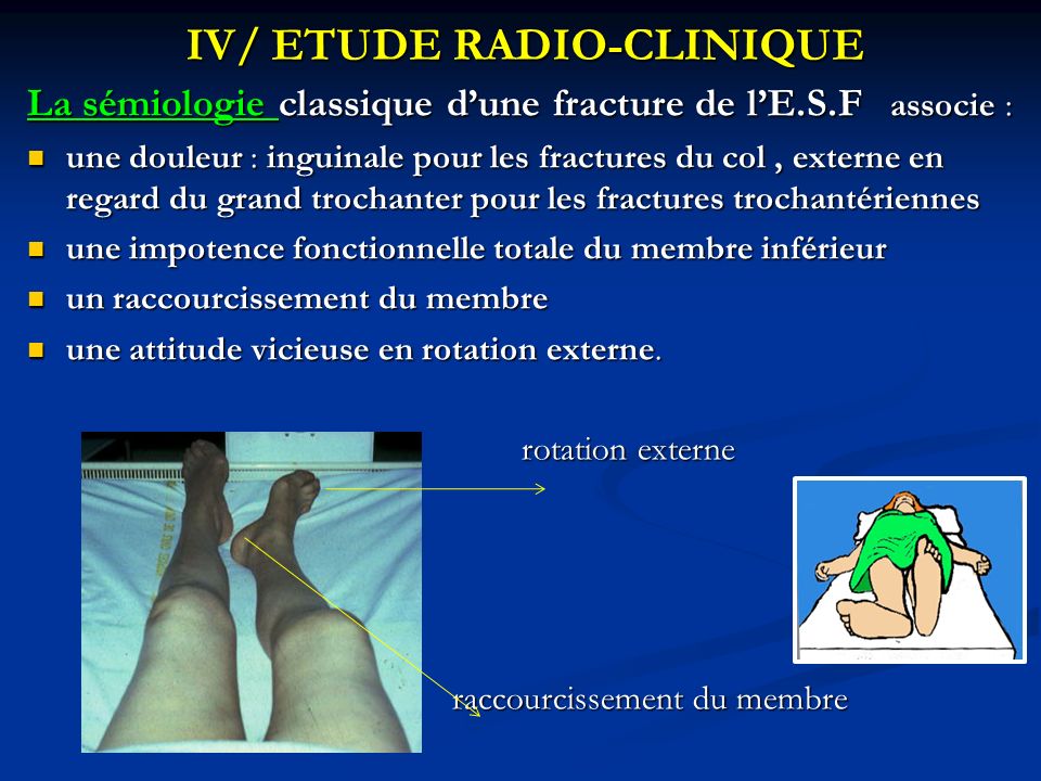 IV/ ETUDE RADIO-CLINIQUE