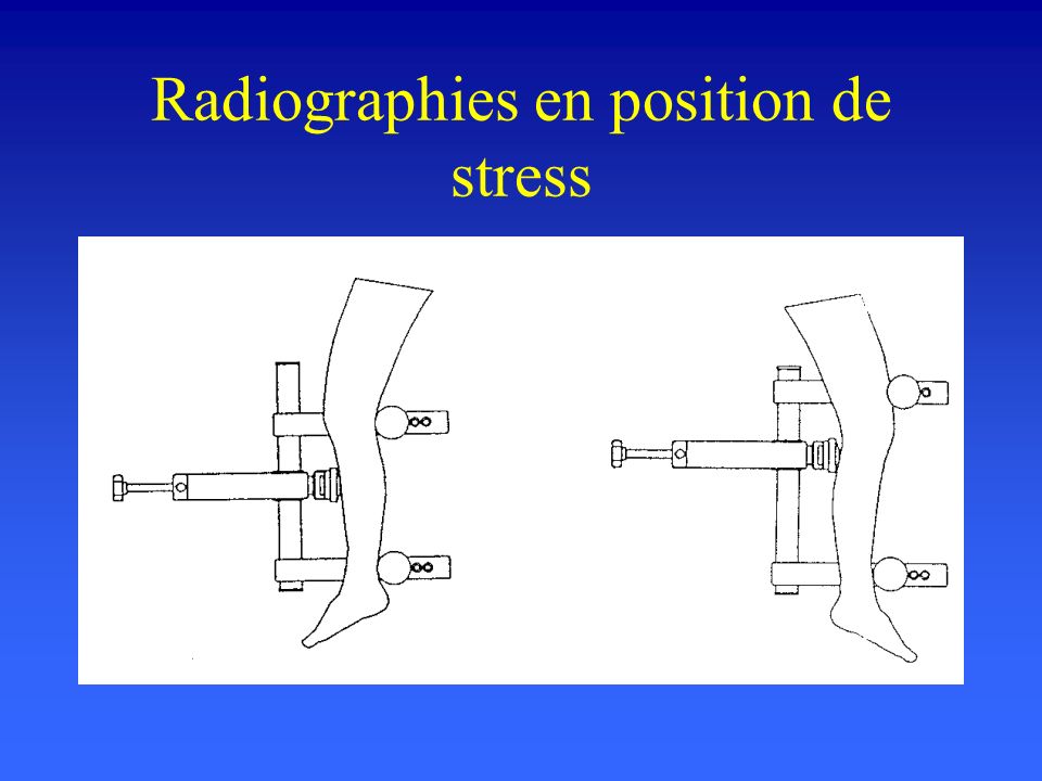 Radiographies en position de stress