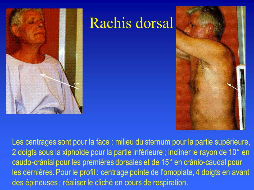 Rachis dorsal
