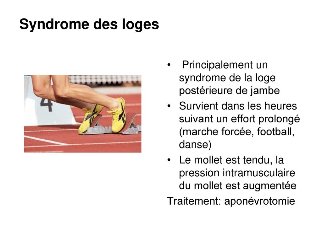 Syndrome des loges Principalement un syndrome de la loge postérieure de jambe.