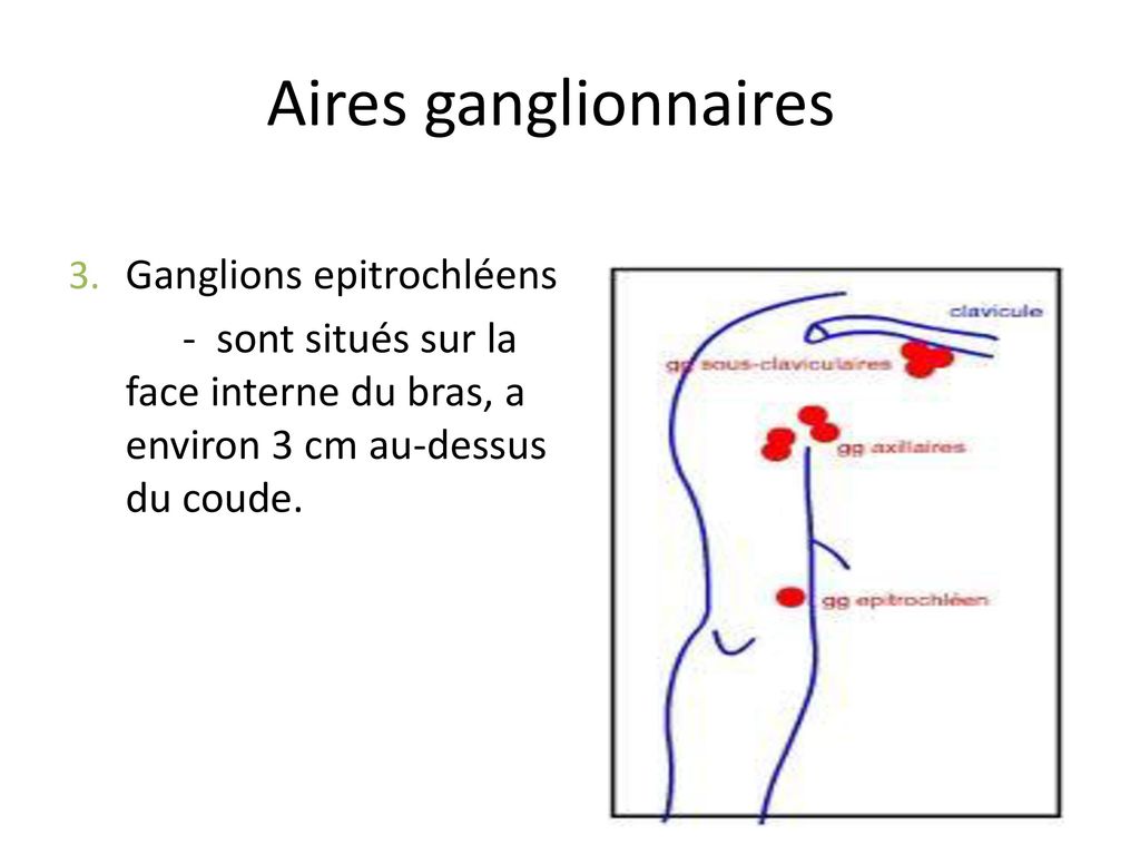 Syndrome ganglionnaire - ppt télécharger