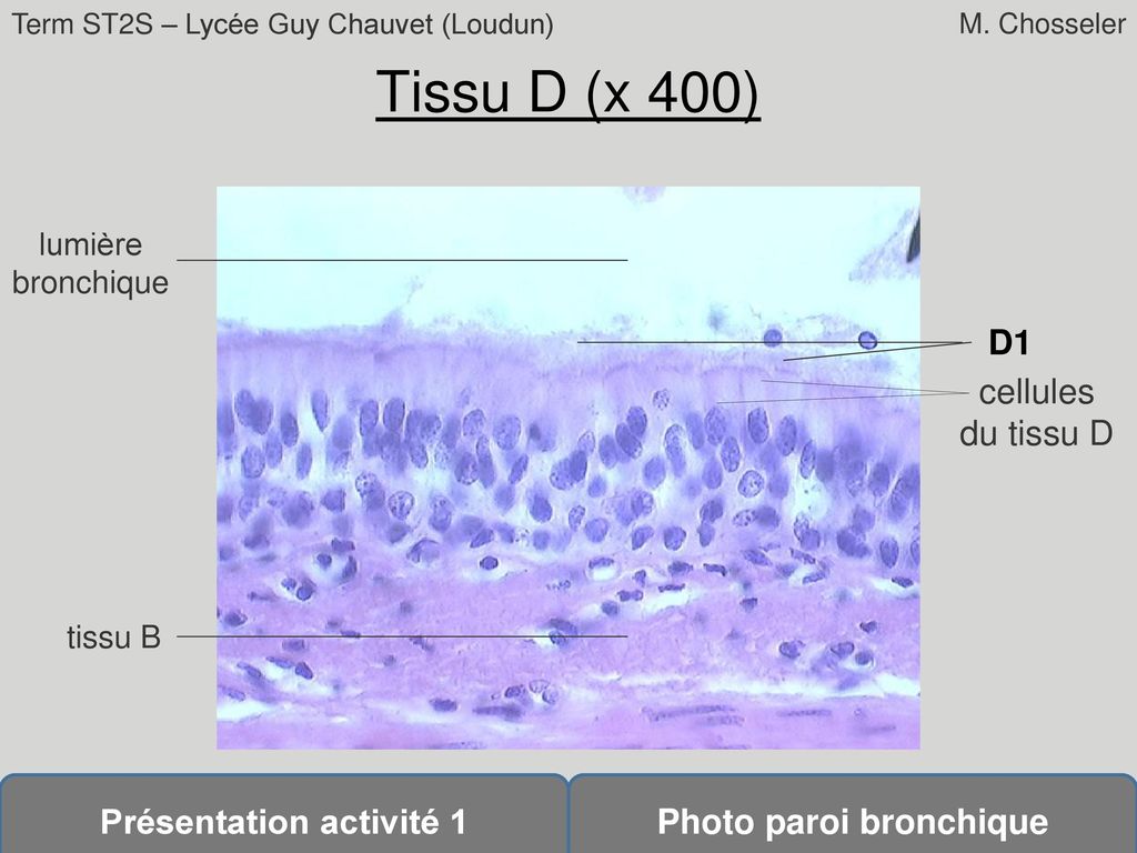 Tissu D (x 400) lumière bronchique D1 cellules du tissu D tissu B