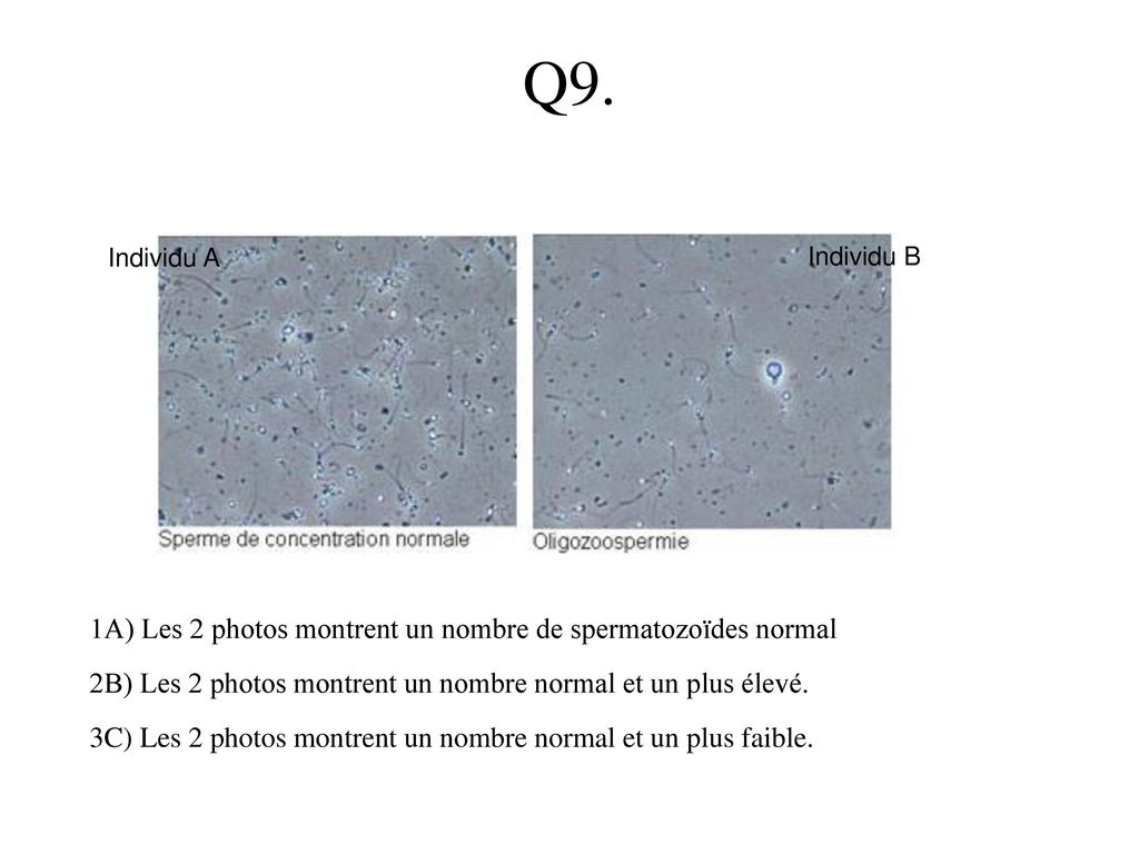 Q9. 1A) Les 2 photos montrent un nombre de spermatozoïdes normal
