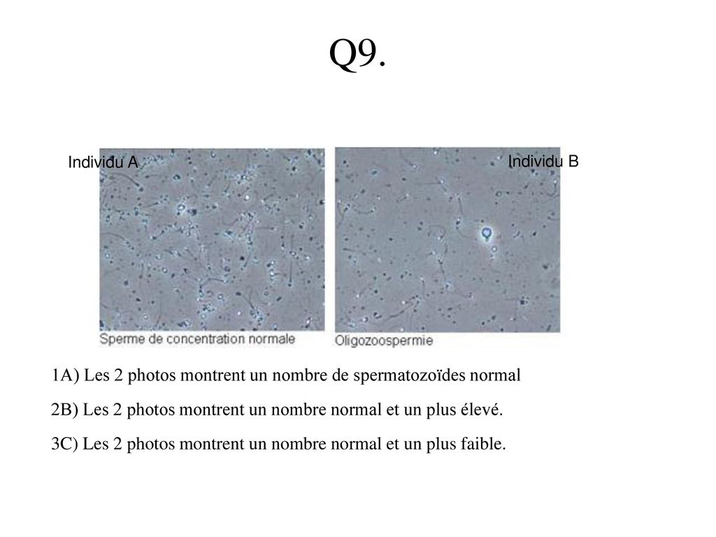 Q9. 1A) Les 2 photos montrent un nombre de spermatozoïdes normal