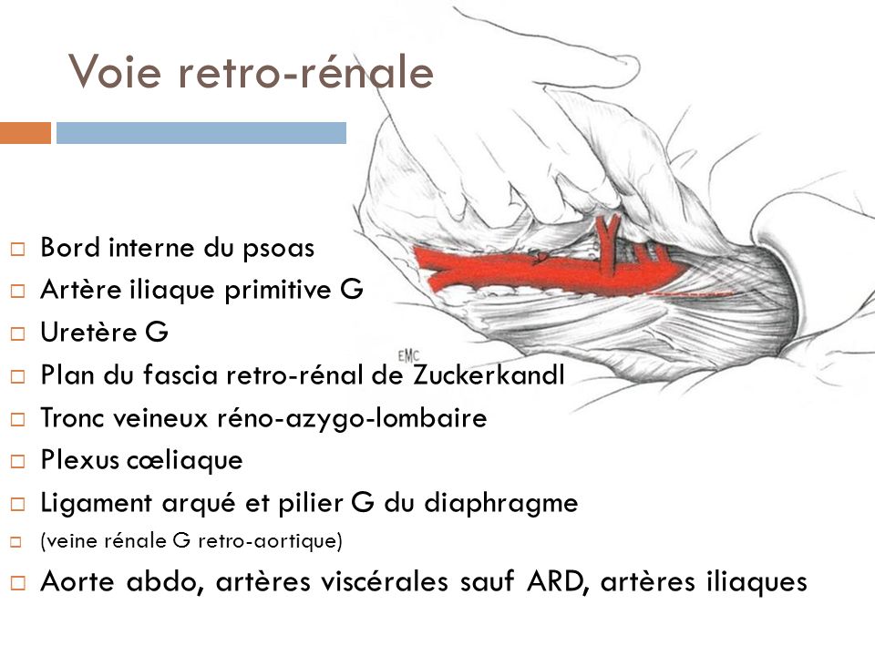 Voie retro-rénale Bord interne du psoas. Artère iliaque primitive G. Uretère G. Plan du fascia retro-rénal de Zuckerkandl.
