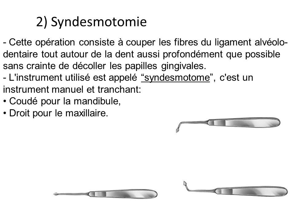 2) Syndesmotomie