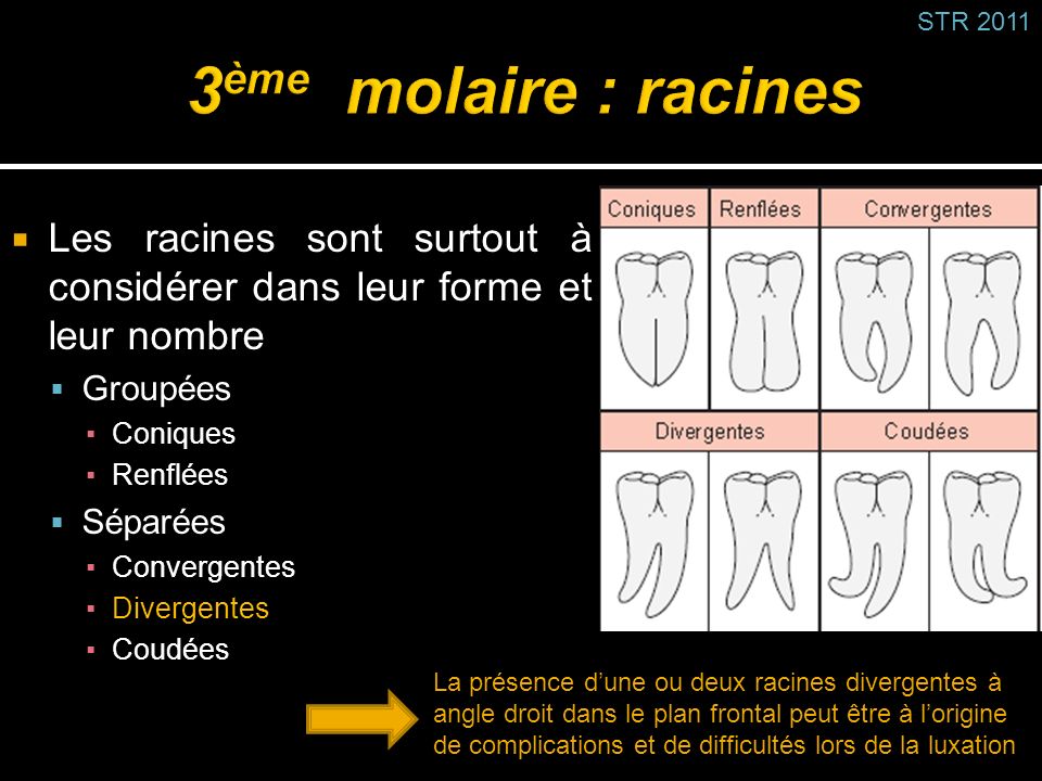 STR ème molaire : racines. Les racines sont surtout à considérer dans leur forme et leur nombre.