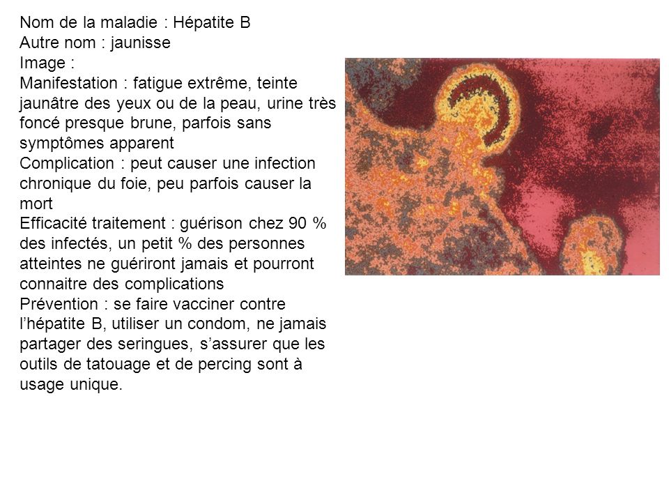 Nom de la maladie : Hépatite B