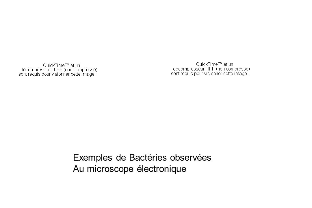 Exemples de Bactéries observées