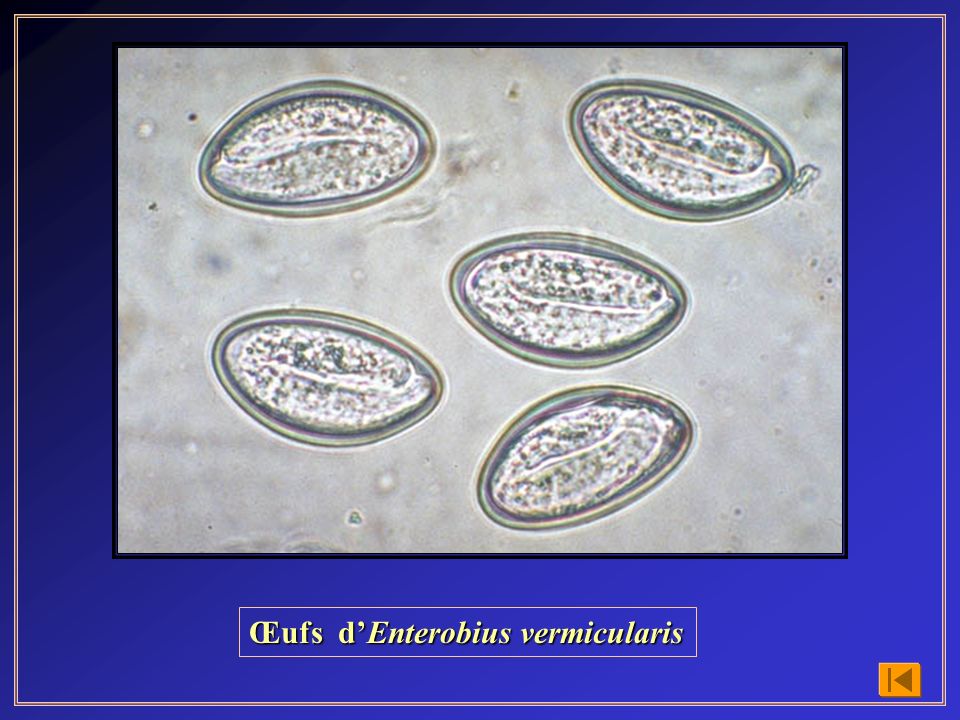 Enterobius vermicularis parasitologia