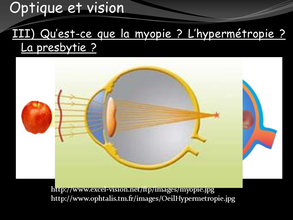 Optique et vision III) Qu’est-ce que la myopie L’hypermétropie La presbytie