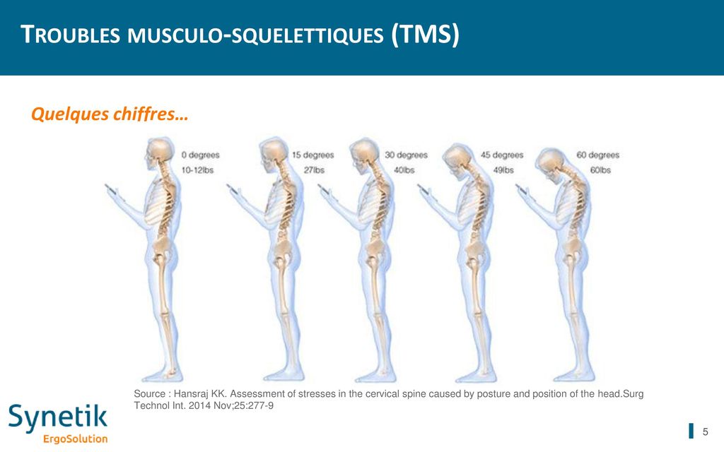 Troubles musculo-squelettiques (TMS)