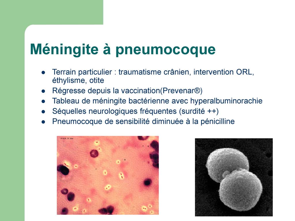 Méningite à pneumocoque