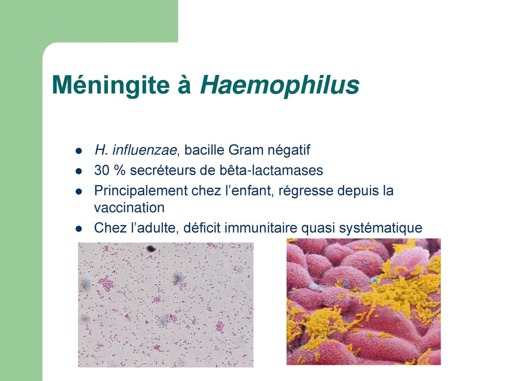 Méningite à Haemophilus