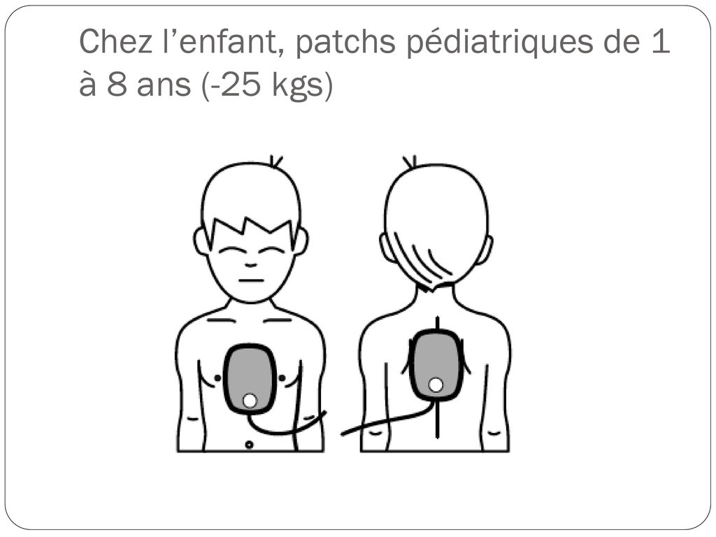 Chez l’enfant, patchs pédiatriques de 1 à 8 ans (-25 kgs)