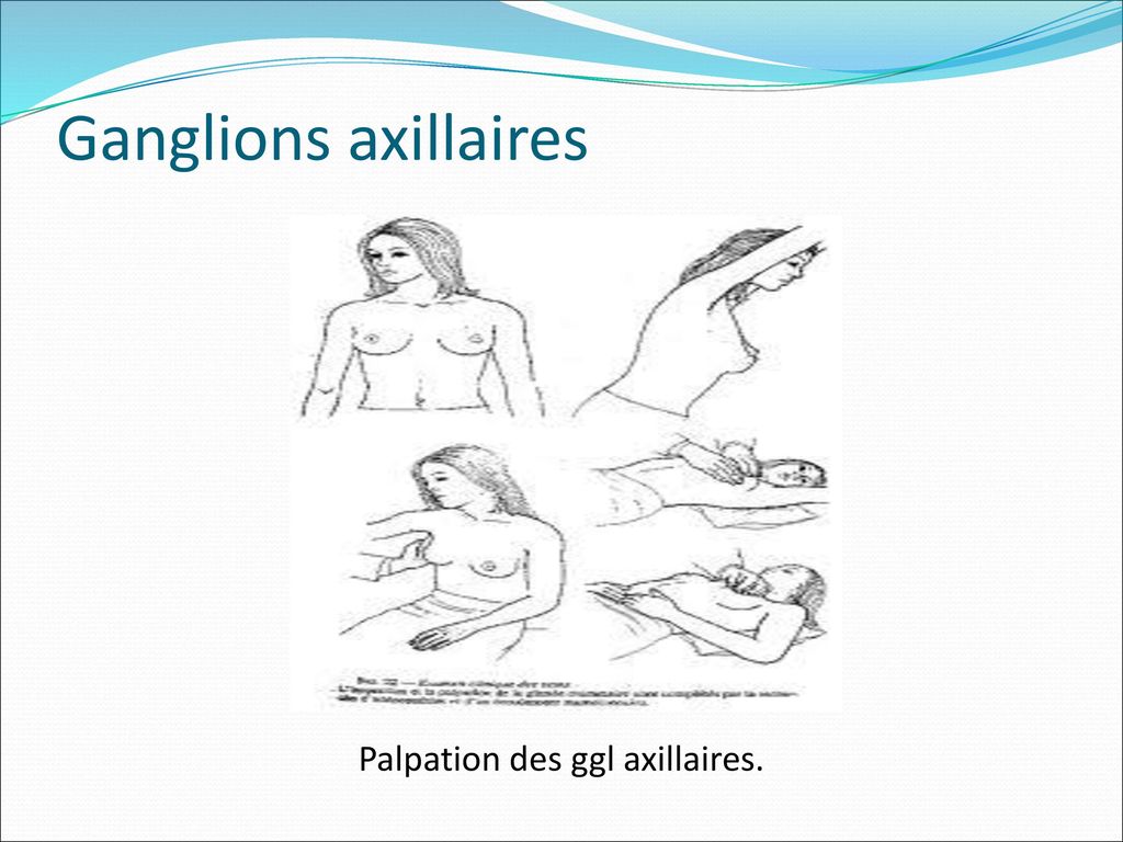 Palpation des ggl axillaires.