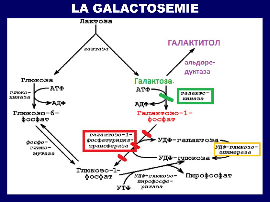 Обмен фруктозы. Галактоземия механизм биохимия. Метаболизм галактозы при галактоземии. Нарушение обмена галактозы биохимия. Галактоземия биохимия схема.