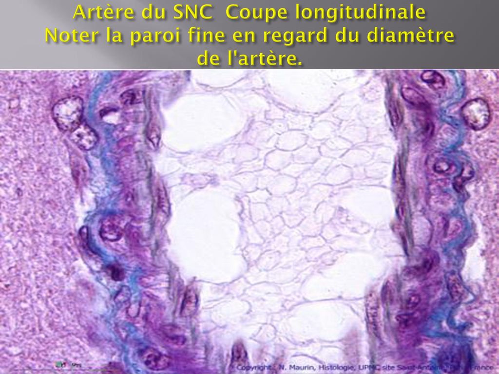 Artère du SNC Coupe longitudinale Noter la paroi fine en regard du diamètre de l artère.