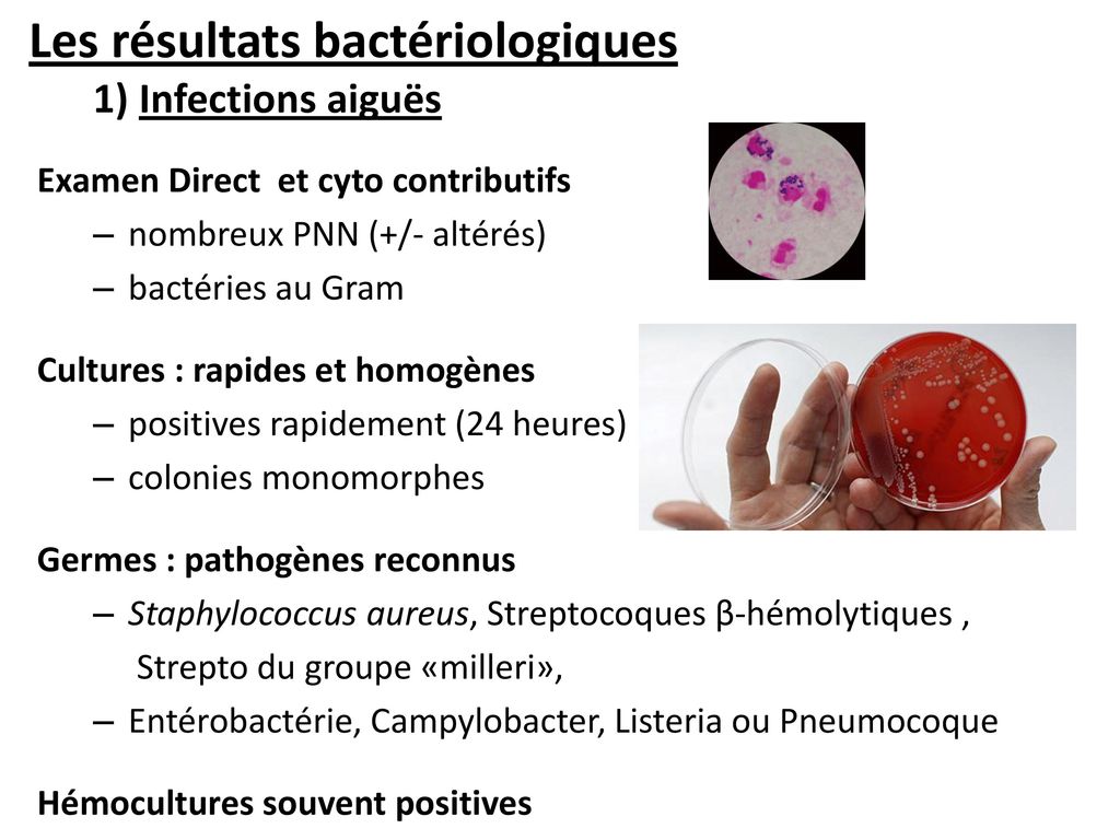 Chloé PLOUZEAU-JAYLE (CHU de POITIERS) Groupe Microbiologie du ...