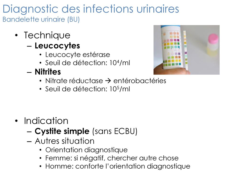 Diagnostic des infections urinaires Bandelette urinaire (BU)