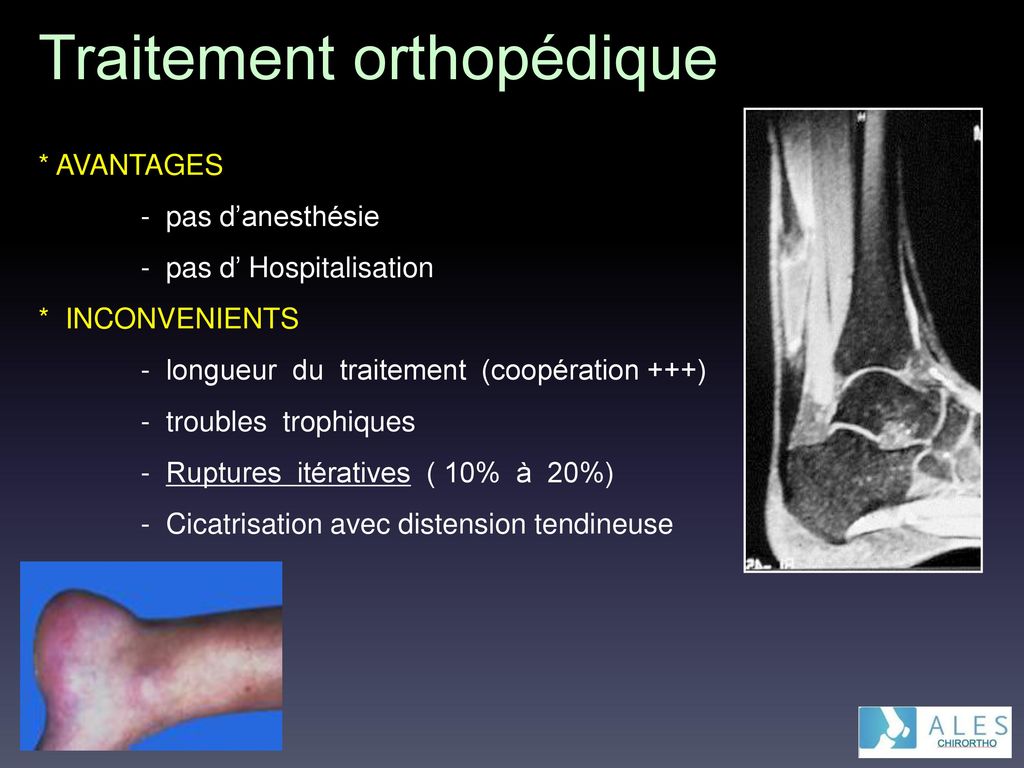 Traitement orthopédique
