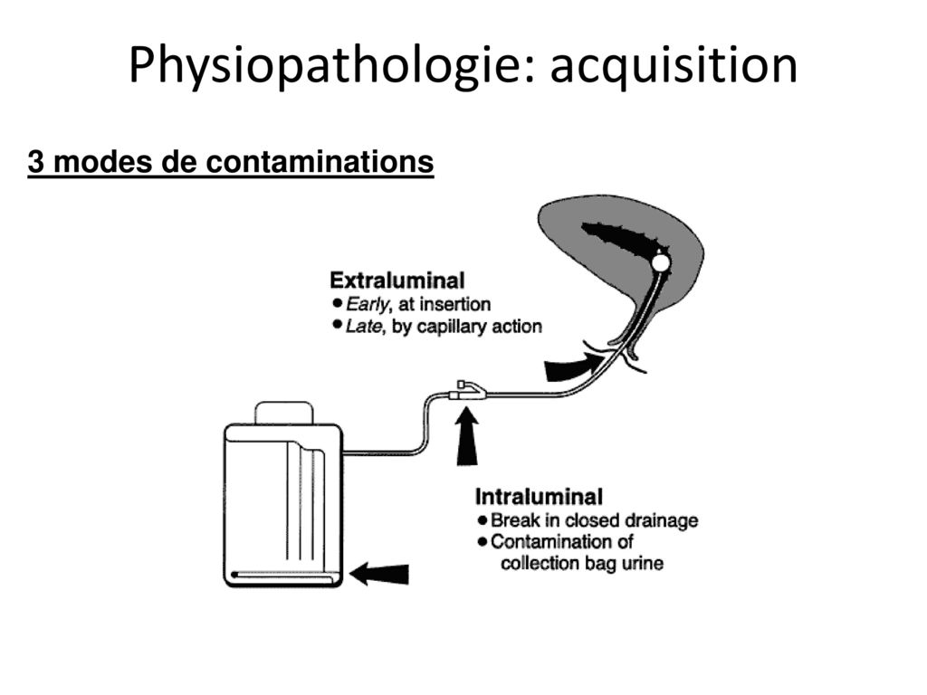 Physiopathologie: acquisition