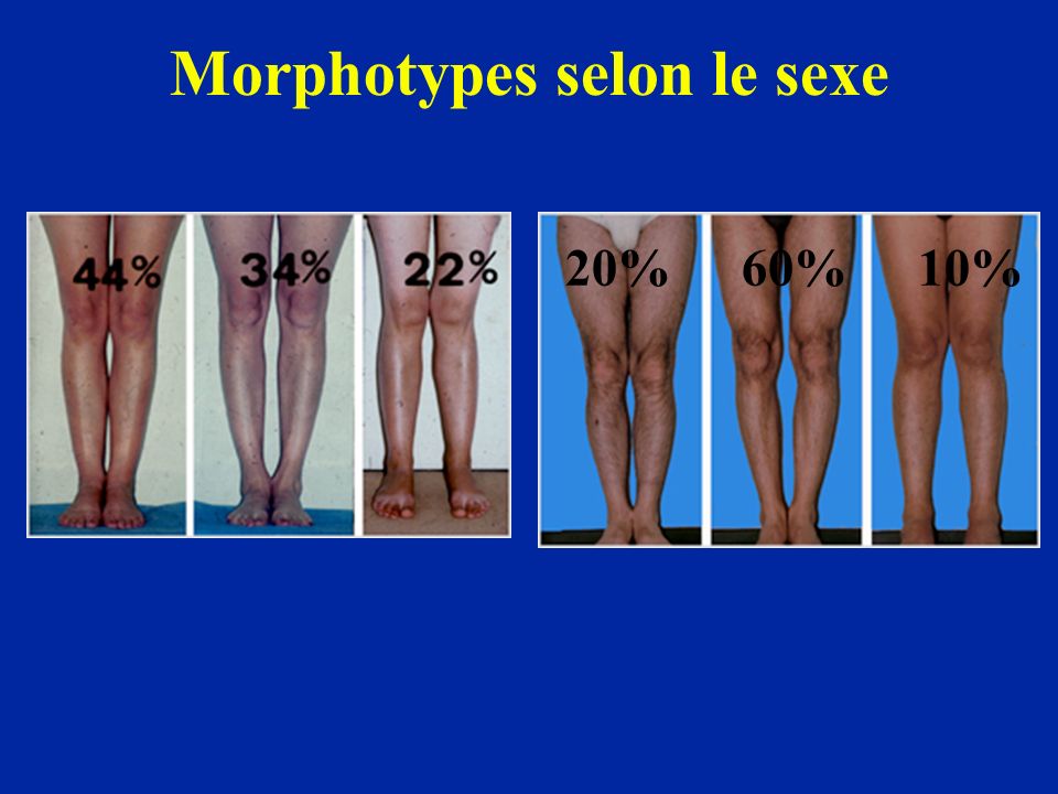 Morphotypes selon le sexe