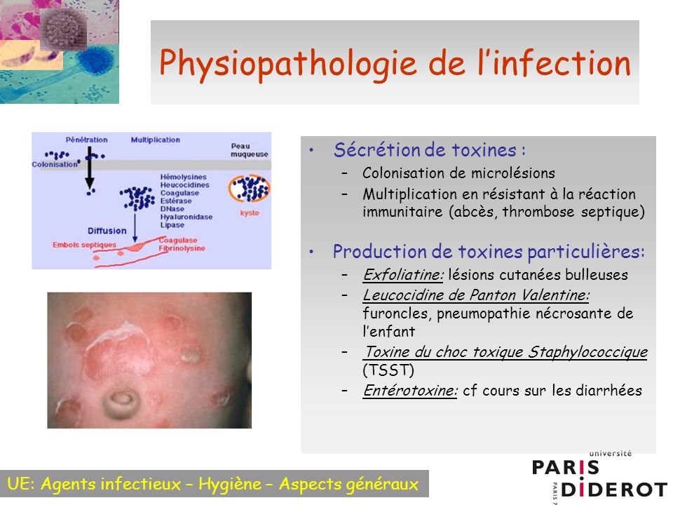 toxine staphylocoque