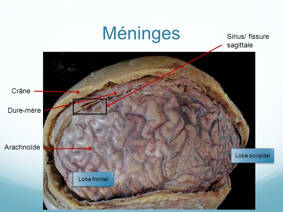 Méninges Sinus/ fissure sagittale Crâne Dure-mère Arachnoïde