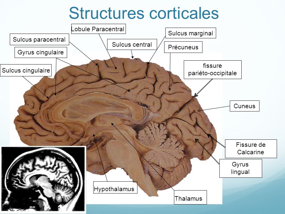 Structures corticales
