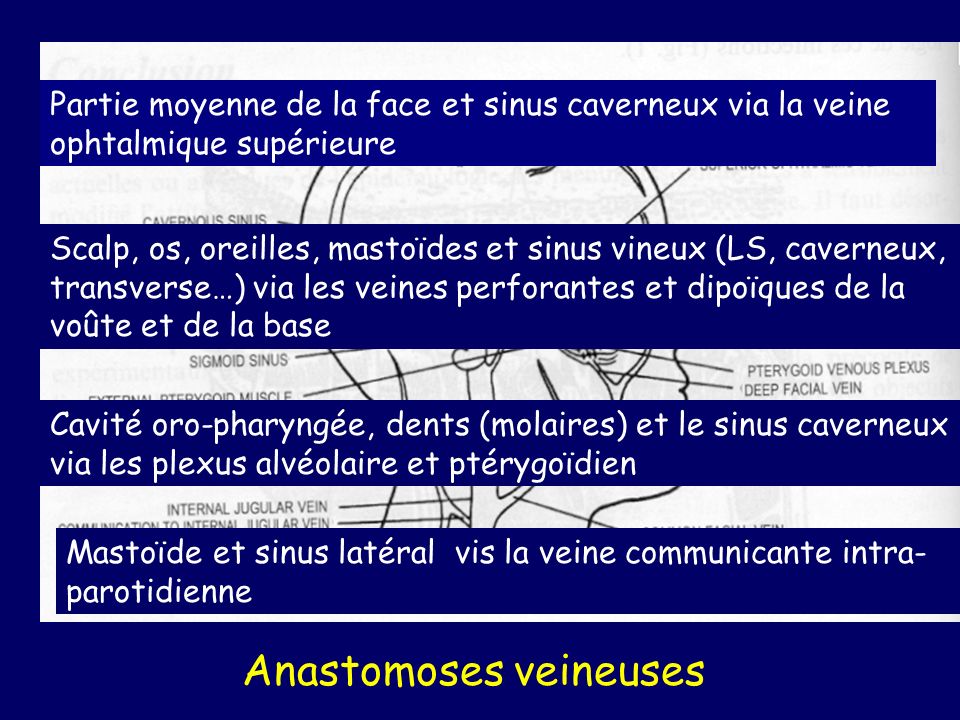 Anastomoses veineuses