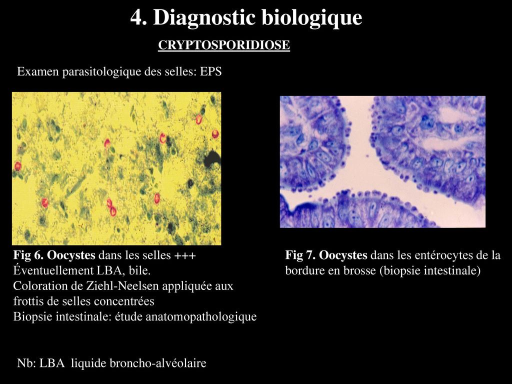 4. Diagnostic biologique