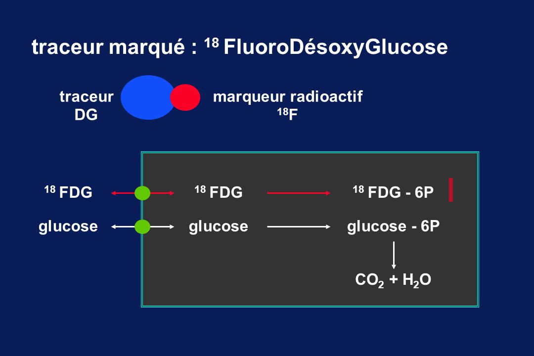 traceur marqué : 18 FluoroDésoxyGlucose