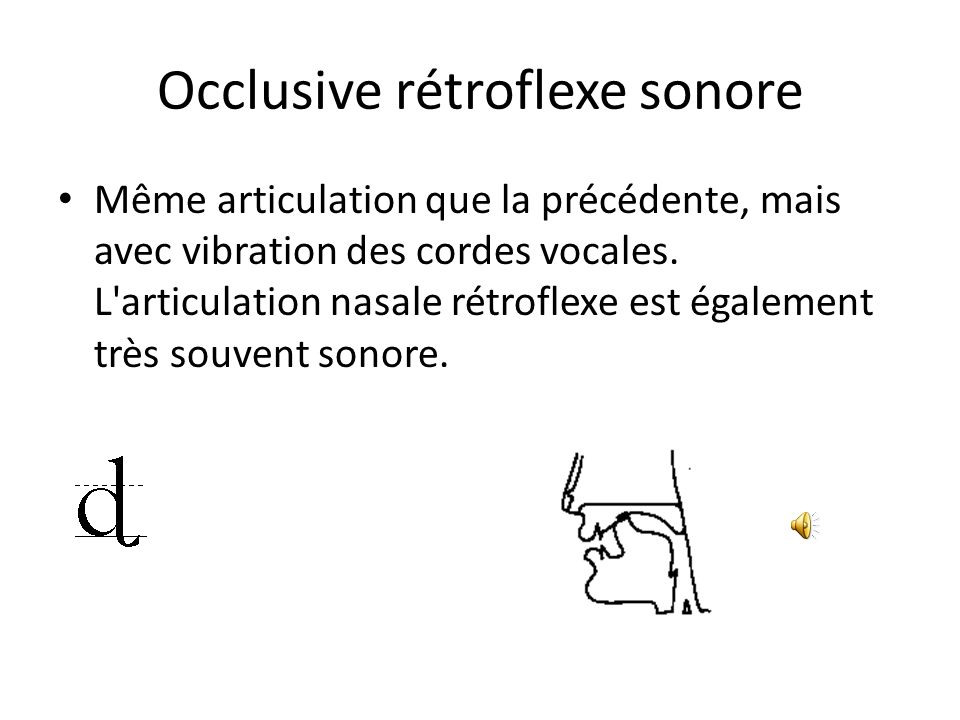 Occlusive rétroflexe sonore