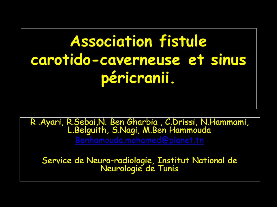 Association fistule carotido-caverneuse et sinus péricranii.