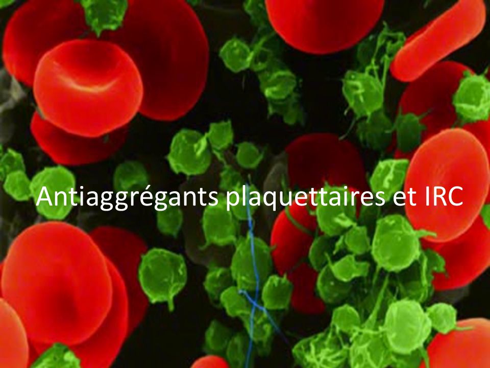 Antiaggrégants plaquettaires et IRC