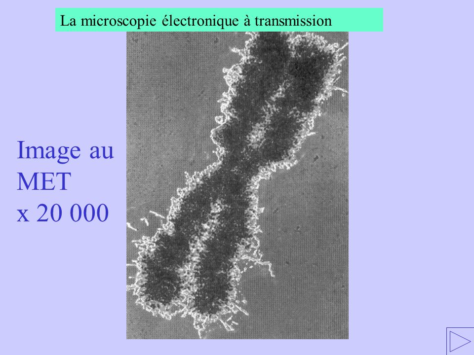 La microscopie électronique à transmission