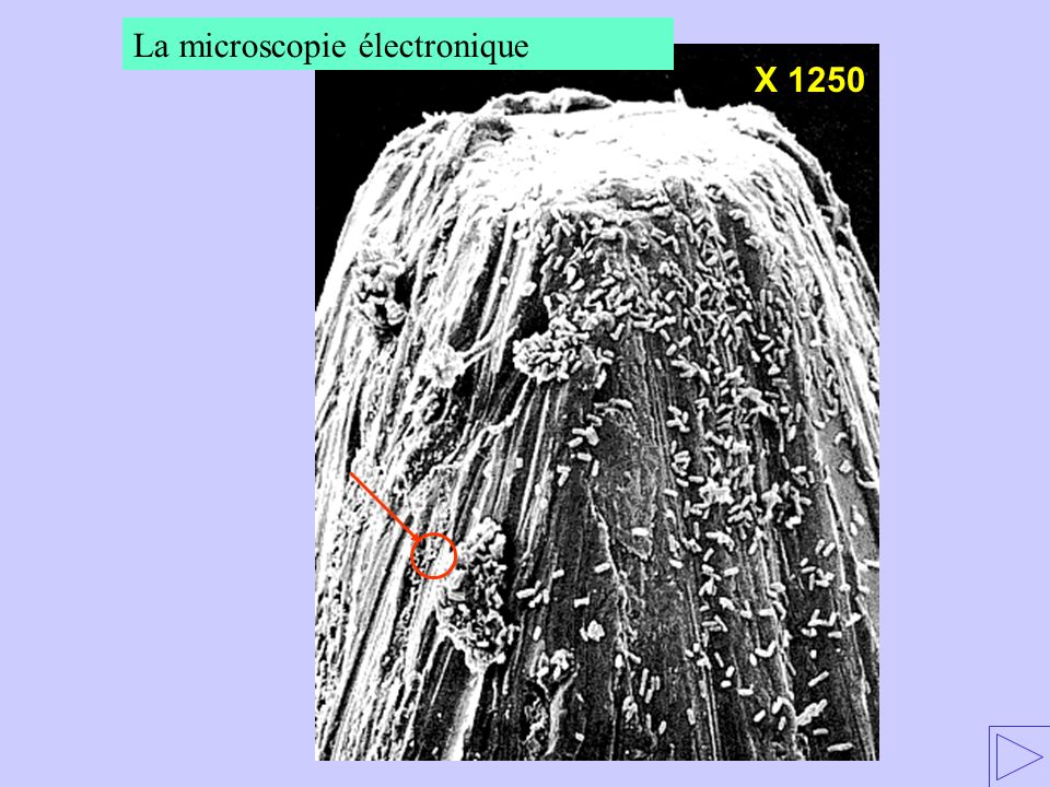 La microscopie électronique