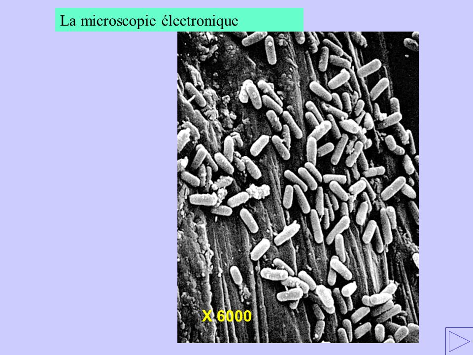 La microscopie électronique