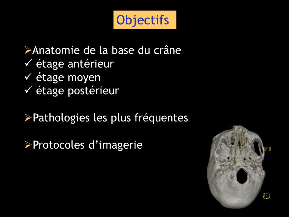Objectifs Anatomie de la base du crâne étage antérieur étage moyen